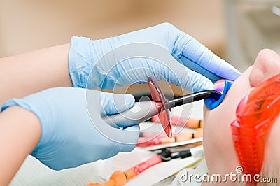 Dentist ultraviolet light equipment Stock Photo