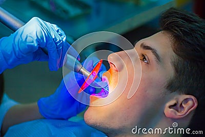 Dentist ultraviolet light equipment. dental Stock Photo