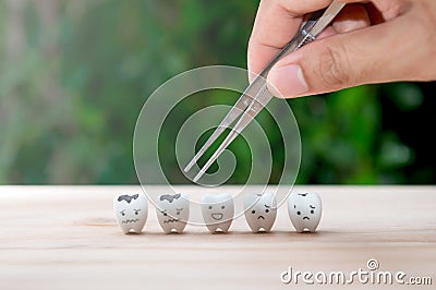 Dentist use tweezers to set of decayed tooth model for dental health care concept Stock Photo