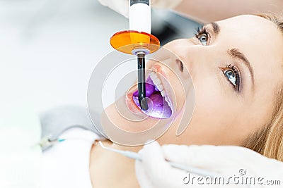 Dentist using dental curing UV lamp on teeth of patient Stock Photo