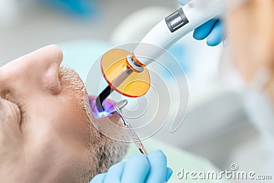 Dentist using dental curing UV lamp on teeth of patient Stock Photo