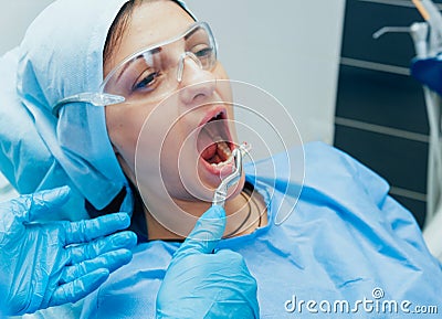 Dentist using surgical pliers to remove a decaying tooth. Stock Photo