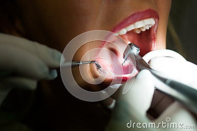 Dentist working closeup Stock Photo