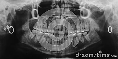 Dentist x-ray Stock Photo