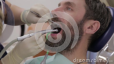 Dentistas do sexo feminino tratam dentes a pacientes do sexo masculino Estomatologista trata cáries nos dentes do paciente Higien filme Dentistas do sexo feminino tratam dentes a pacientes do sexo masculino Estomatologista trata cáries nos dentes do paciente Higien filme