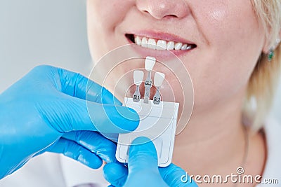 Dentistry. matching colour of the tooth enamel with whitening chart Stock Photo