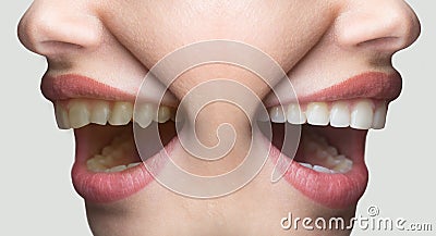 Dentistry white smile concept, before and after, teeth whitening. Female smile on funny face, advertisement for dentist Stock Photo