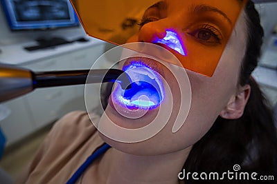 Dentists examining female patient with dental curing light Stock Photo