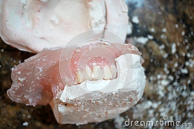 Denture Making Process of Removing From the Mold Stock Photo