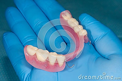 Denture. Partial removable denture of the lower jaw of a person with white beautiful teeth in the hand of a dentist. Aesthetic Stock Photo