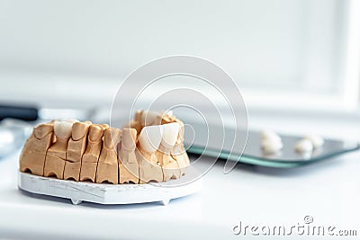 Dentures, veneers, crowns, implants are made in a dental laboratory Stock Photo