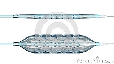 Deployed and collapsed stent ready for angioplasty isolated on white background 3D rendering illustration. Medical, surgery, Cartoon Illustration