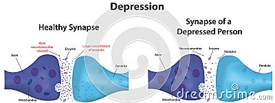 Depression Vector Illustration