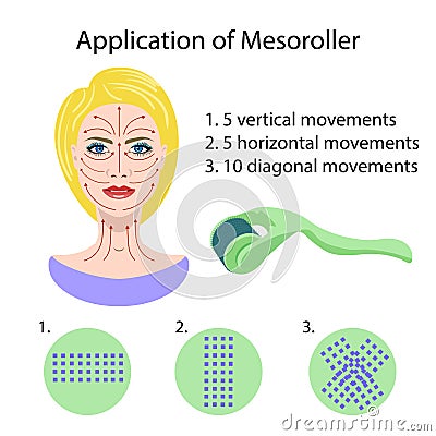 Dermaroller for mesotherapy. Isolated on white background. Vector Illustration