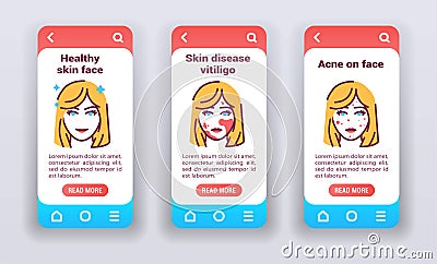 Dermatological diseases in face on mobile app onboarding screens. Vector Illustration