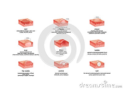 Dermatological elements in various diseases Vector Illustration