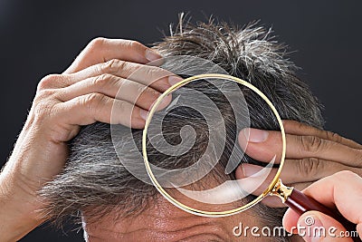 Dermatologist Checking Patient`s Hair Stock Photo