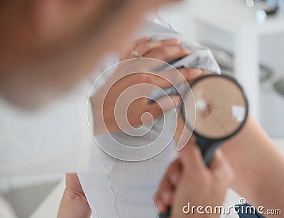 Dermatologist examining mole Stock Photo