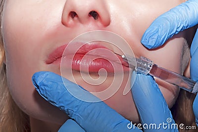 Dermatologist performs contour plastic in the lips with filler Stock Photo