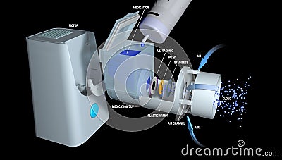 Descriptive drawing of how a portable nebulizer works for the treatment of asthma on a black background. Stock Photo