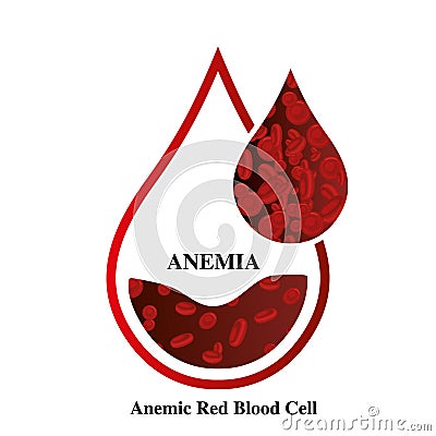 Anemia amount of red blood Iron deficiency anemia difference of Anemia amount of red blood cell and normal symptoms vector illustr Vector Illustration