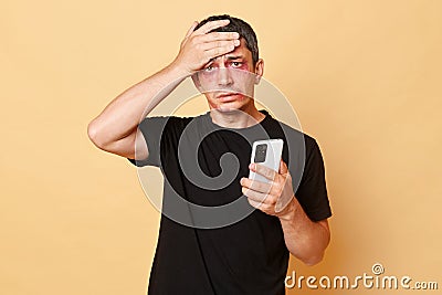 Despair sufferer man in black T-shirt with bruises and abrasions on his face isolated over beige background holding mobile phone Stock Photo