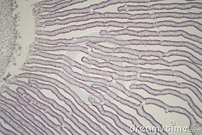 Coprinus mushroom under the microscope Stock Photo