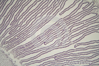 Coprinus mushroom under the microscope Stock Photo