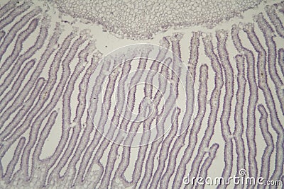 Coprinus mushroom under the microscope Stock Photo