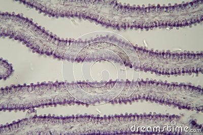 Coprinus mushroom under the microscope Stock Photo