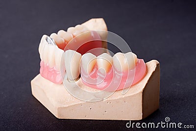 Detail dental wax model Stock Photo