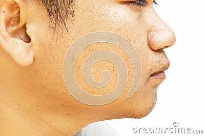 Pores and oily on surface young asian man face skin do not take care for a long time Stock Photo