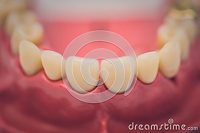 Detailed close up of dental denture or teeth on a table Stock Photo