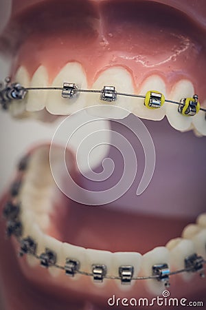 Detailed close up of dental denture or teeth on a table Stock Photo