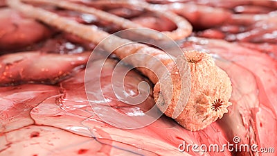 Detailed pork tapeworm under the microscope-3d rendering Stock Photo