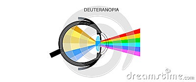 Deuteranomaly and deuteranopia Vector Illustration