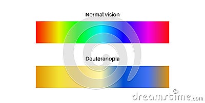 Deuteranomaly and deuteranopia Vector Illustration