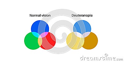 Deuteranomaly and deuteranopia Vector Illustration