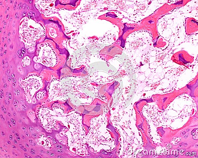 Developing bone. Epiphyseal ossification Stock Photo