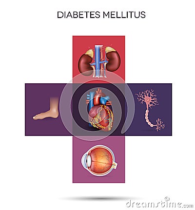 Diabetes mellitus affected organs Vector Illustration