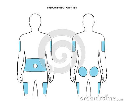 Insulin injection sites Vector Illustration