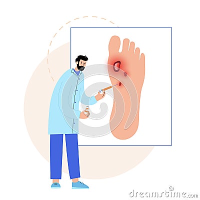 Diabetic Foot Ulcers Vector Illustration