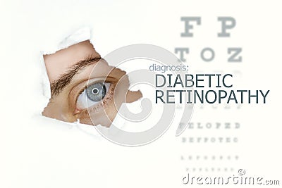 Diabetic retinopathy disease poster with eye test chart and blue eye. Stock Photo