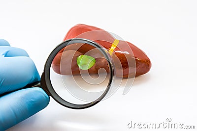Diagnosis of gallbladder for presence of disease. Doctor hand in glove examine with magnifying glass gallbladder on liver anatomi Stock Photo