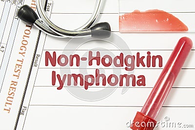 Diagnosis of Non-Hodgkin lymphoma. Laboratory blood bottle, glass slide with blood smear, hematology test, stethoscope lying on no Stock Photo