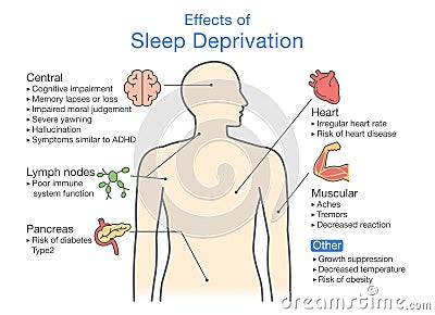 Diagram of Effects of Sleep deprivation. Vector Illustration