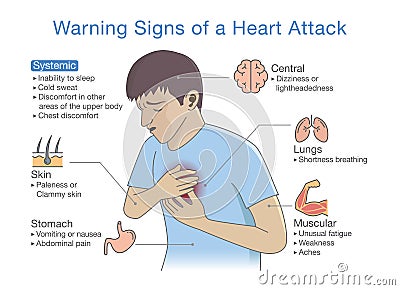 Diagram about warning signs of a heart attack. Vector Illustration