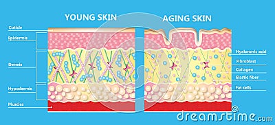 The diagram of younger skin and aging skin Vector Illustration