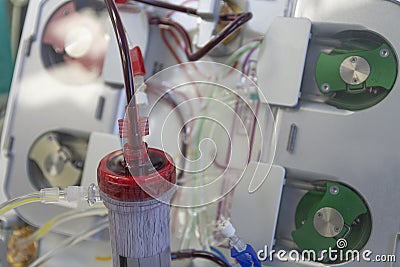 Dialyzer with two upper ports, on backgroud dialysis machine in ICU in hospital Stock Photo