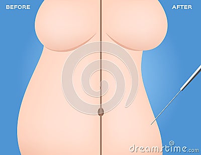 Before and after a diet woman on blue background . Vector Illustration